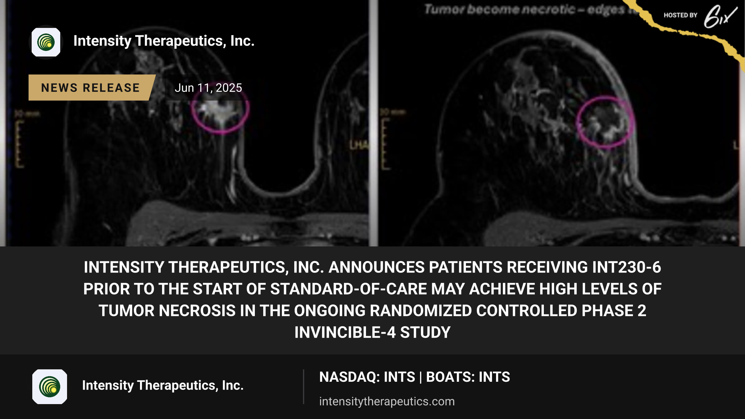 Intensity Therapeutics, Inc. Announces Patients Receiving INT230-6 Prior to the Start of Standard-of-Care May Achieve High Levels of Tumor Necrosis in the Ongoing Randomized Controlled Phase 2 INVINCIBLE-4 Study