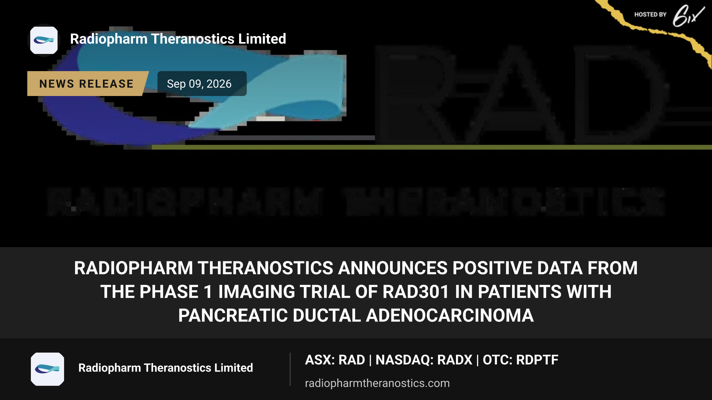 Radiopharm Theranostics Announces Positive Data from the Phase 1 Imaging Trial of RAD301 in Patients with Pancreatic Ductal Adenocarcinoma