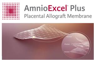 AmnioExcel® Plus