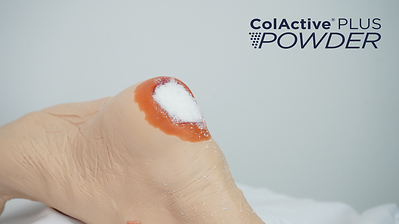 ColActive® Plus Powder (CNW Group/Covalon Technologies Ltd.)