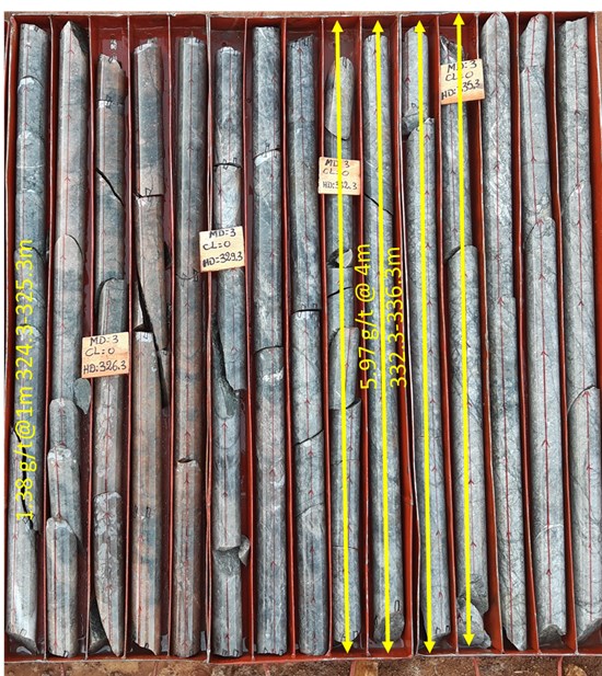 Figure 5: Drill Core Photo DDMan21-104B showing high grade sections mineralization in the altered felsic intrusive at MS1