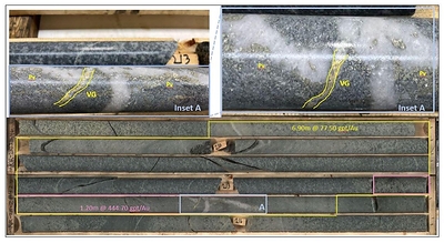 Figure 3: Core sample photo from Hole MKR-24-002 (Boxes 46 & 47), displaying high-grade gold intercepts over 6.9 meters (208.5–215.4 m) at 77.40 g/t, including 1.2 meters at 445 g/t. Inset A shows deformed smoky quartz-sulphide veins with visible gold veinlets in highly altered granodiorite/tonalite intrusive rock.