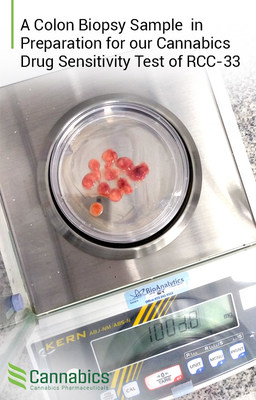 A Colon Biopsy Sample in Preparation for our Cannabics Drug Sensitivity Test