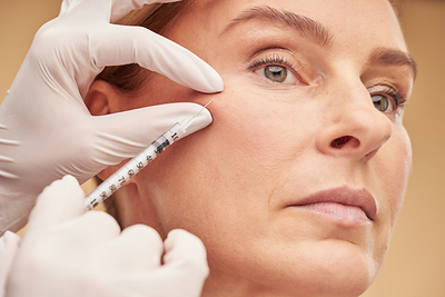 CollPlant achieved a milestone related to its dermal filler program in collaboration with AbbVie, which triggered a related milestone payment in the second quarter of 2023.
