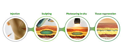 Schematic representation of the injection, sculpting, photocuring, and tissue regeneration phases in a photocurable dermal filler application