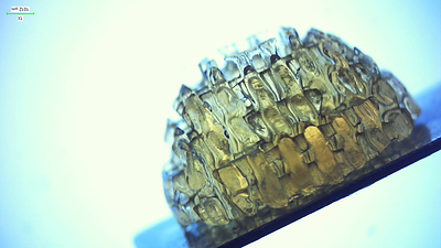3D Bioprinted breast implant produced by CollPlant and currently used in preclinical studies.