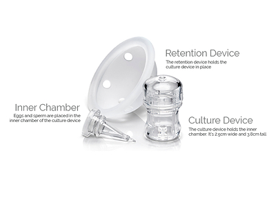 INVOcell is an innovative medical device that allows fertilization and early embryo development to take place in vivo within the body.