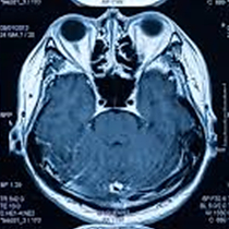 Imaging sample (CNW Group/Nanalysis Scientific Corp.)