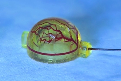 3D printed soft tissue implant, including blood vessels